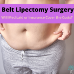 Copy of Belt Lipectomy Surgery