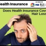 Does Health Insurance Cover Hair Loss