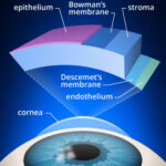 layers of cornea 330x371 1